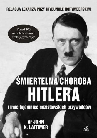 Śmiertelna choroba Hitlera i inne - okładka książki